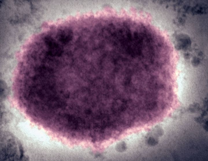 Africa CDC warns on vaccine hoarding amid monkeypox outbreak