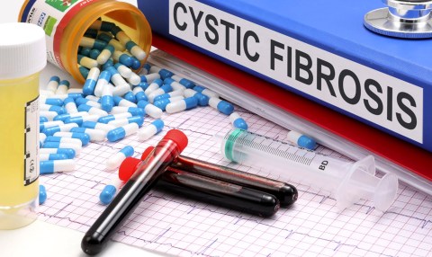 New screening programme planned for cystic fibrosis in South Africa